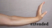 carpal tunnel syndrome : wrist extension